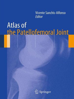 cover image of Atlas of the Patellofemoral Joint
